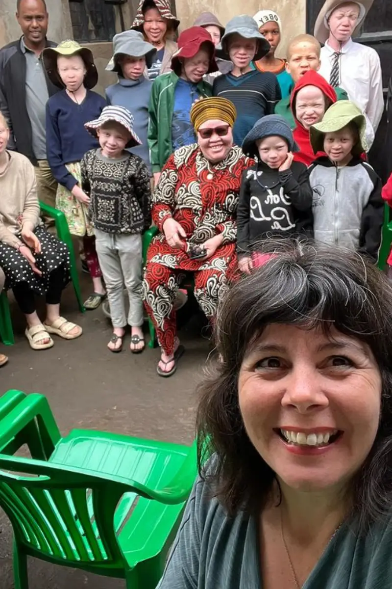 Legacy Exchange Outfitters supporting children with albinism in Tanzania